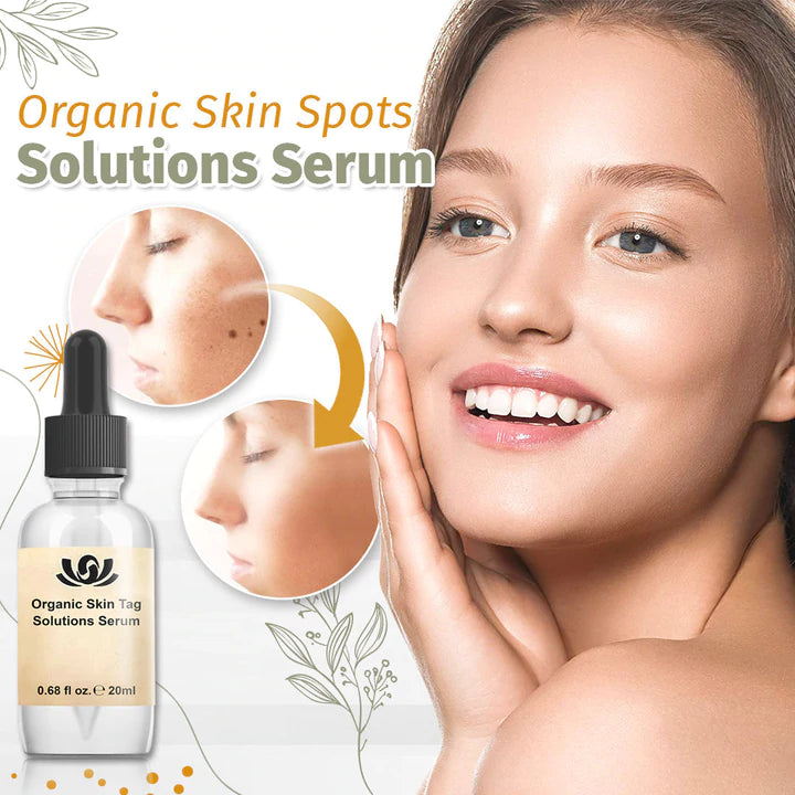 SpotFree™ - Bio-Lösung für Hautunreinheiten Serum