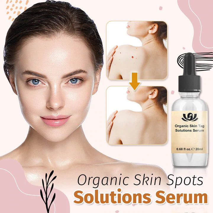 SpotFree ™ - Soluzione organica per le macchie della pelle Siero