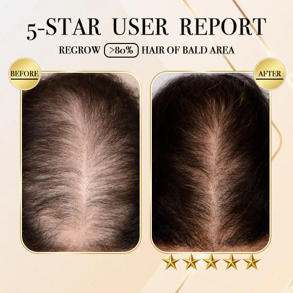 1+1 GRATUIT | Shampooing pour la croissance des cheveux au gingembre