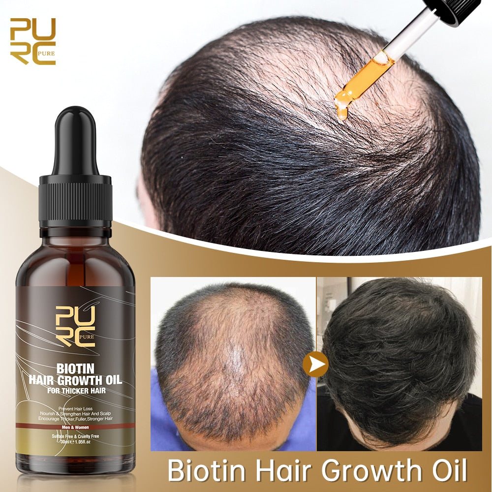 BioPurc™ Aceite para el crecimiento del cabello (1+1 Gratis)